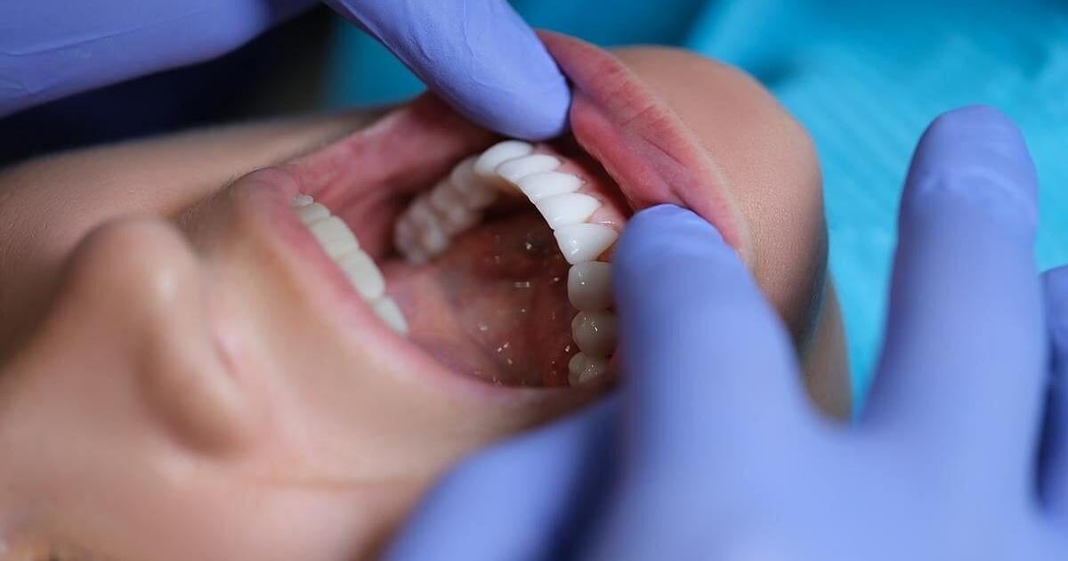 Oral Health Linked To Migraines, Fibromyalgia | Health