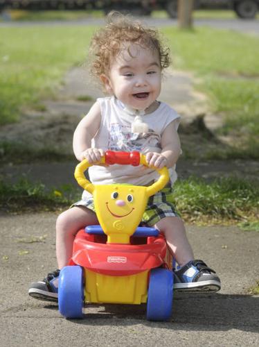 As if by magic, docs 'print' airway splint, save Ohio boy    