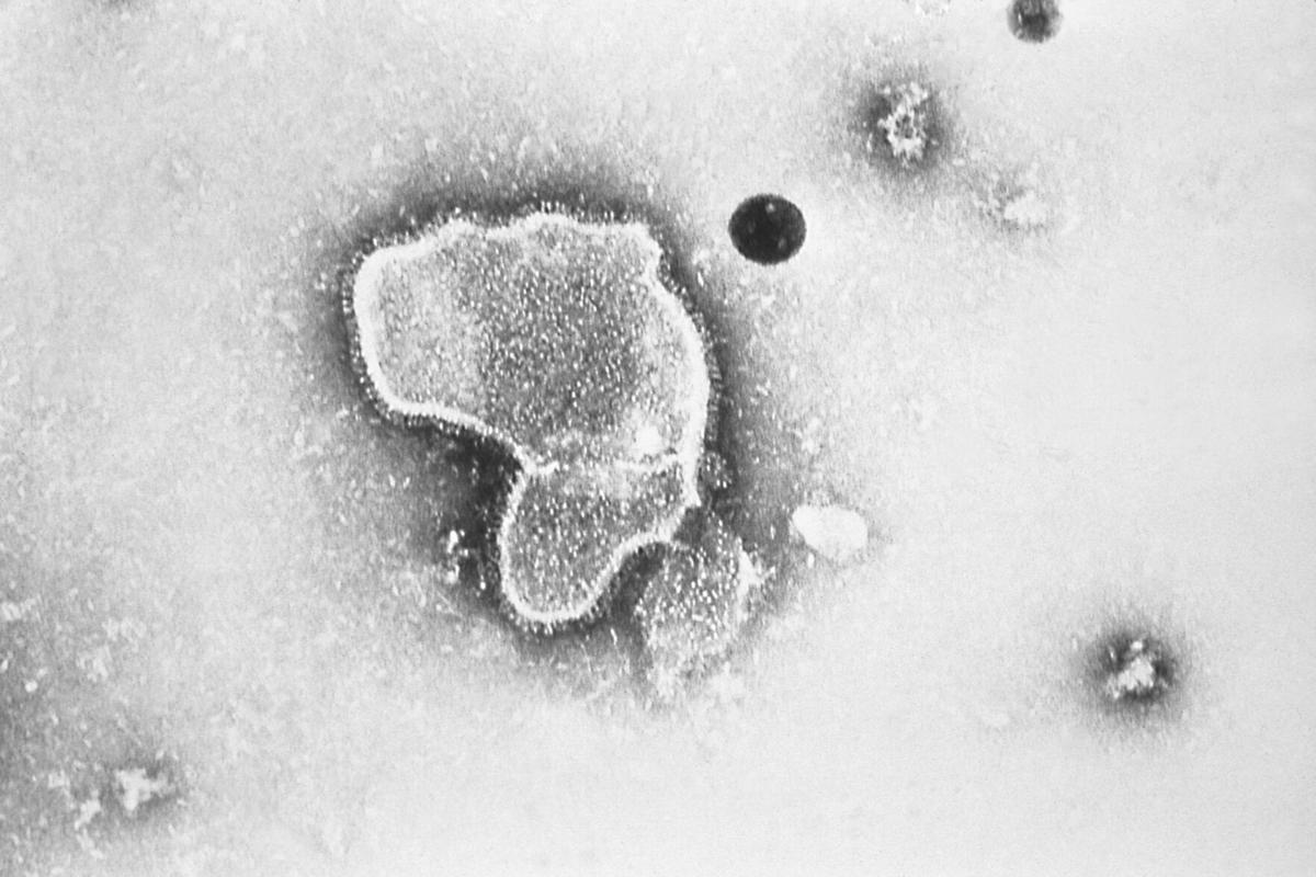 RSV vaccines
