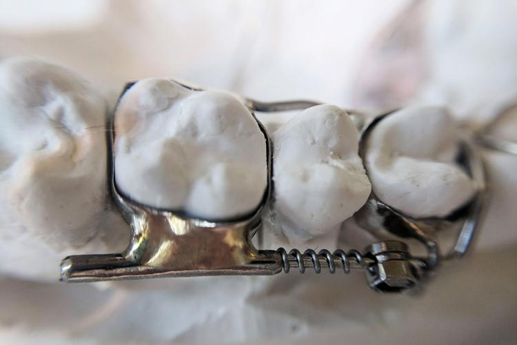 US-NEWS-DENTAL-DEVICE-FDA-1-KHN