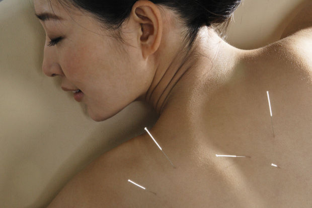 Acupuncture