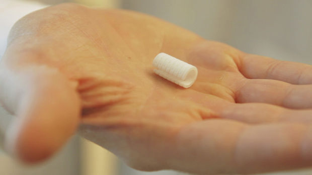 As if by magic, docs 'print' airway splint, save Ohio boy    