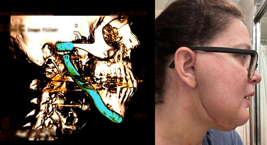 Feldman-CBCT-Collage-with-Scar.jpg