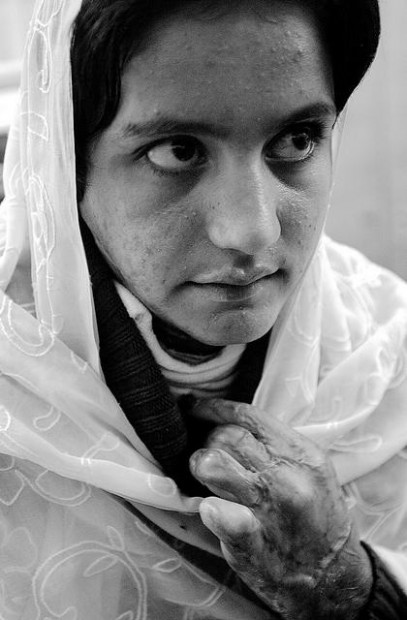 Afghan girls' marriage escape is fire  