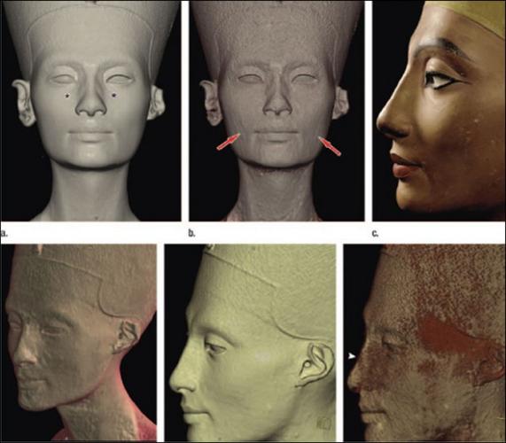 CT scan reveals hidden face under Nefertiti bust