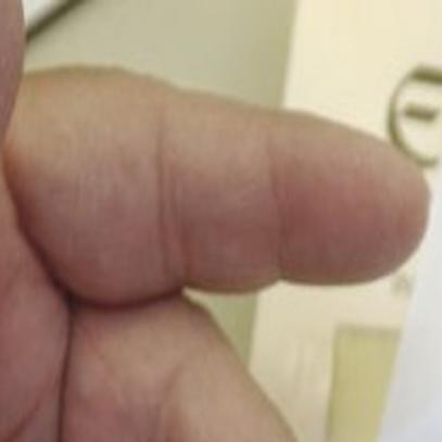 Ignore The Clickbait Metformin Still Prescribed For Diabetics Healthy Aging Tucson Com