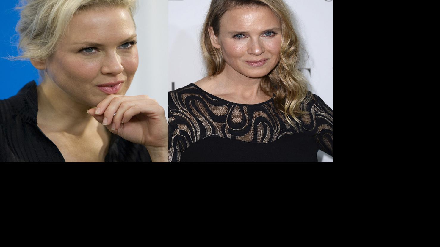 Photos: Renee Zellweger before and after | Celebrities ...