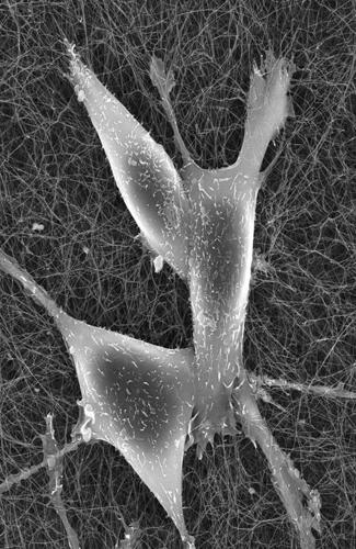 Chemotherapy treatment