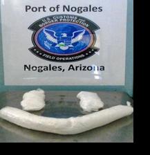 Woman sues Customs over body cavity search, which hospital billed her for