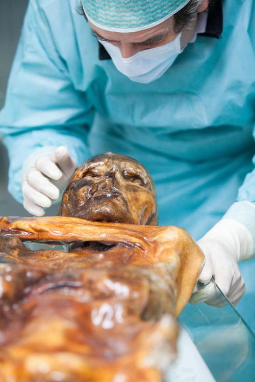 A researcher examines the mummified remains of Otzi in South Tyrol