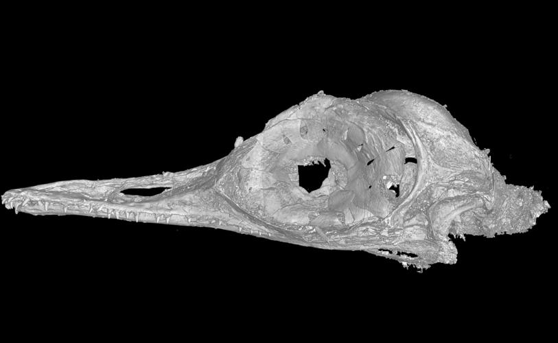 A CT scan of the skull