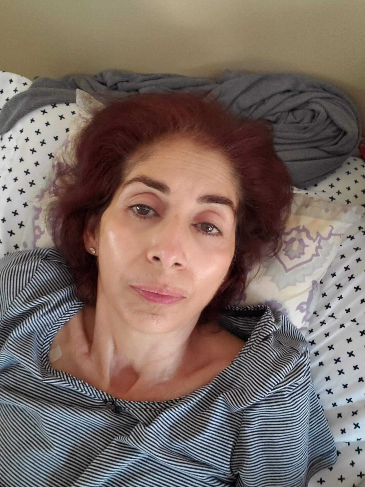 Donación de órganos