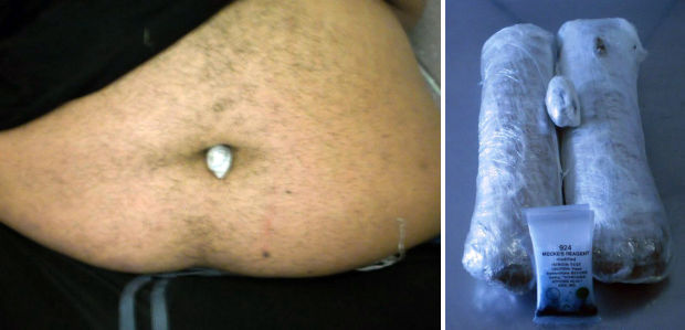 Border officers: Tucson man hid heroin in bellybutton