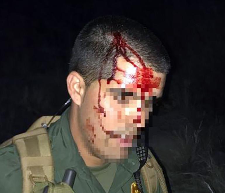 Tucson Sector Border Patrol: Immigrant smashed agent’s head into rock