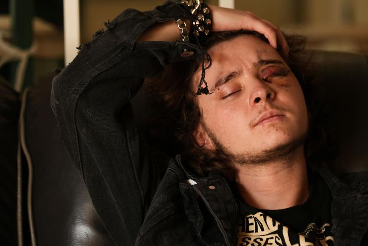 California Protester Injured