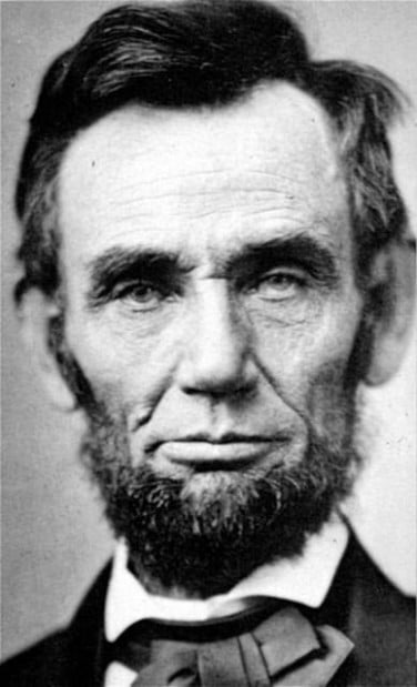 Lincoln may have survived shooting if treated with modern medicine  