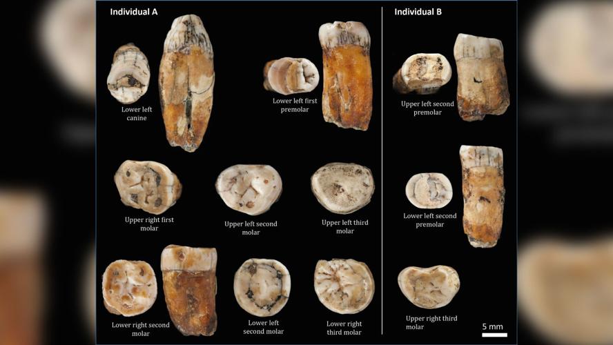 Neanderthal teeth