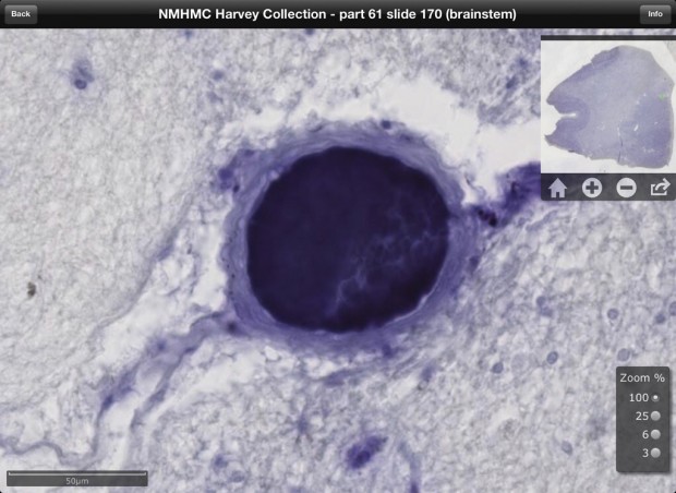 Now on a $9.99 iPad app: Einstein's brain    