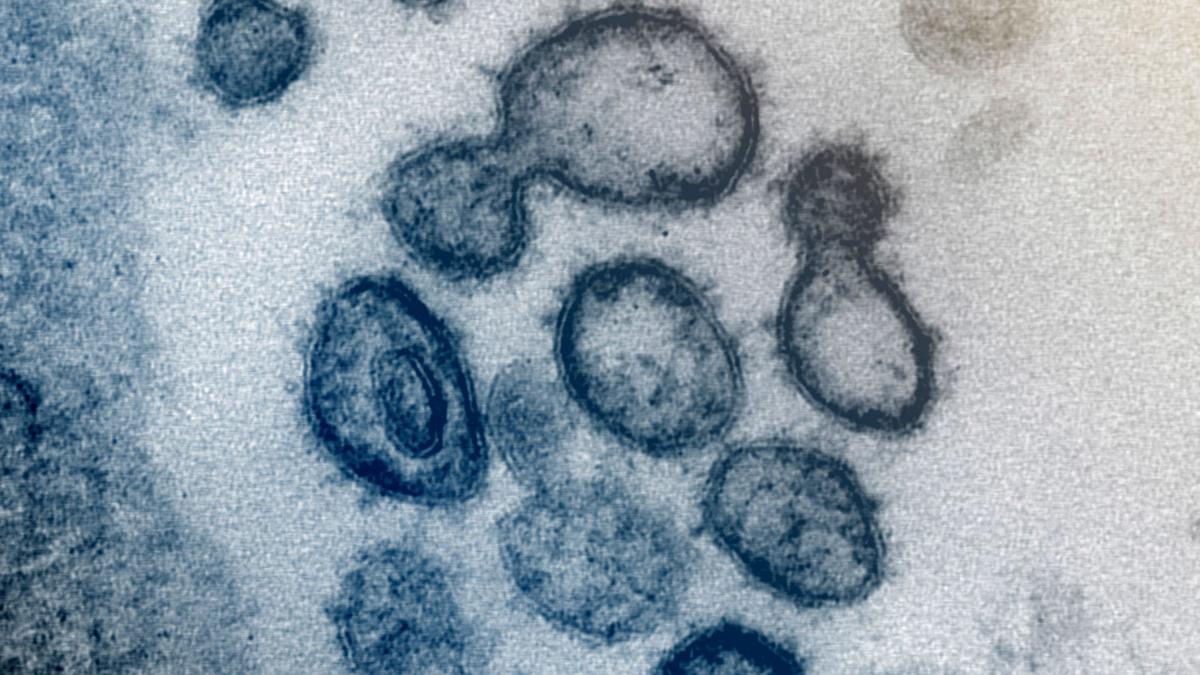 Coronavirus, COVID 19