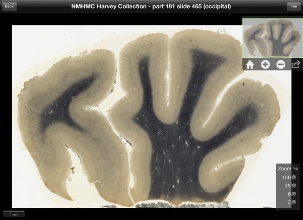 Now on a $9.99 iPad app: Einstein's brain    