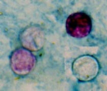 How to stay healthy during cyclosporiasis outbreak