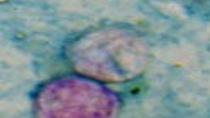 How to stay healthy during cyclosporiasis outbreak