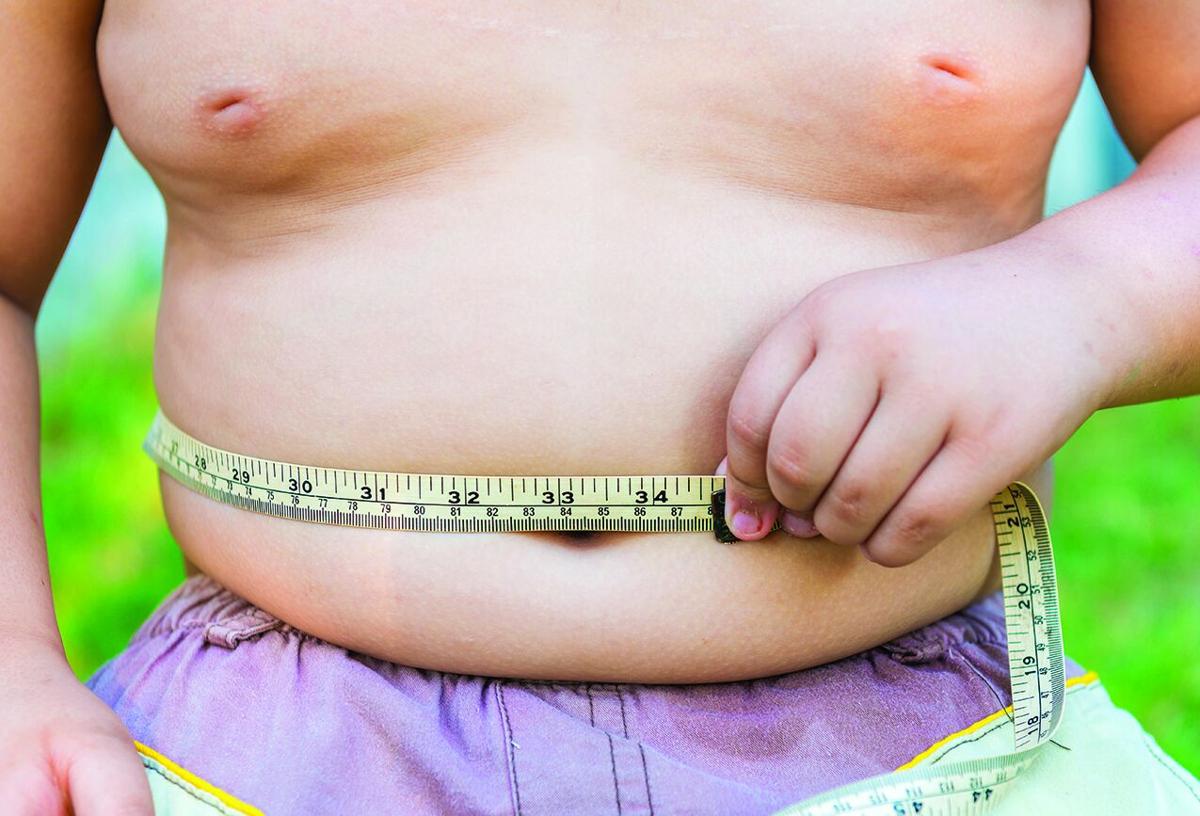 Significant factors affecting childhood obesity