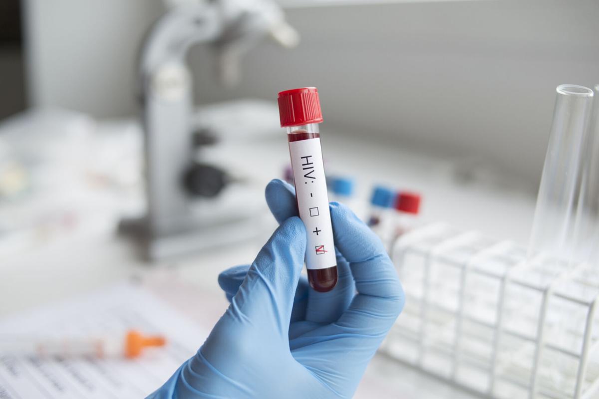 Diagnostician holding in hand a positive HIV test.