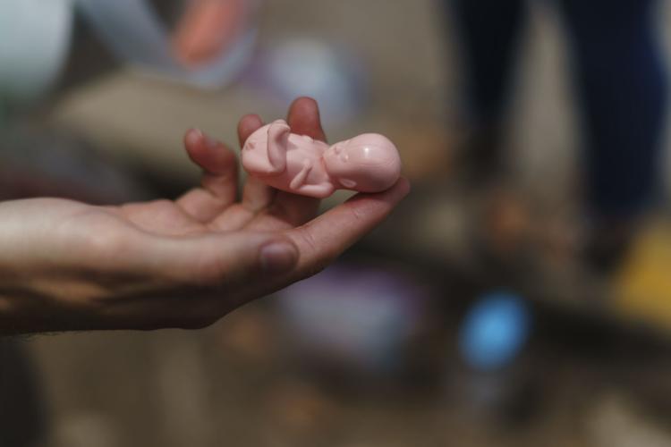 Abortion Opponents