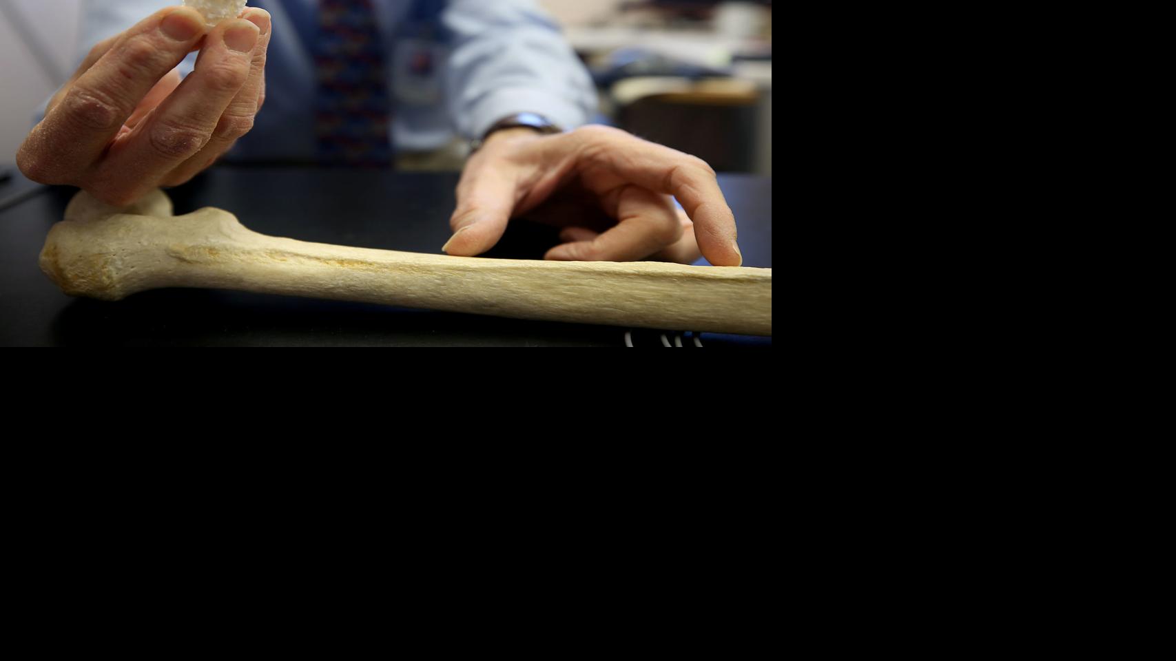 Military grant helping UA researchers develop better ways to regrow damaged bones Local news