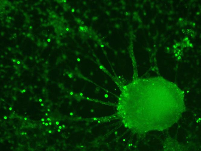 Play a Video Game Against a Dish of Living Neurons: Intactis Bio Launches "Biostack"