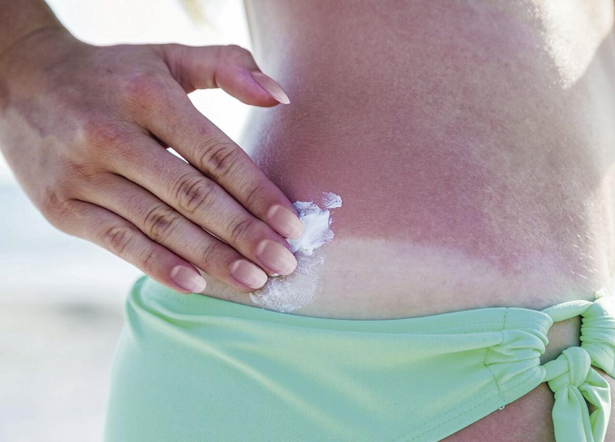 Healthy exposure to the sun