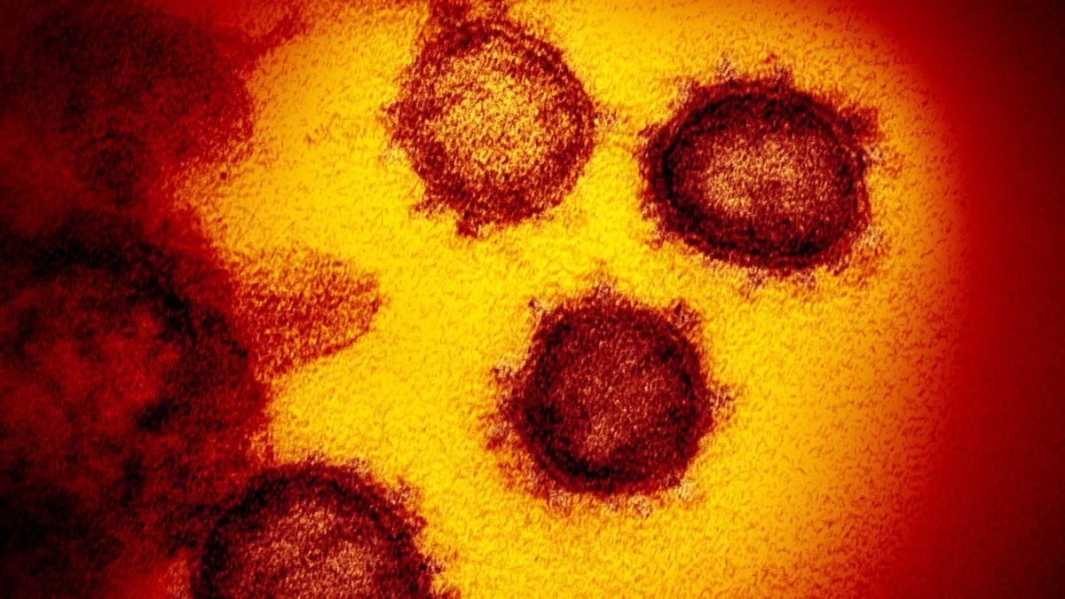 Coronavirus test