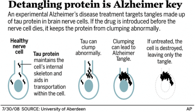 Drug shows promise of halting Alzheimer's advance  