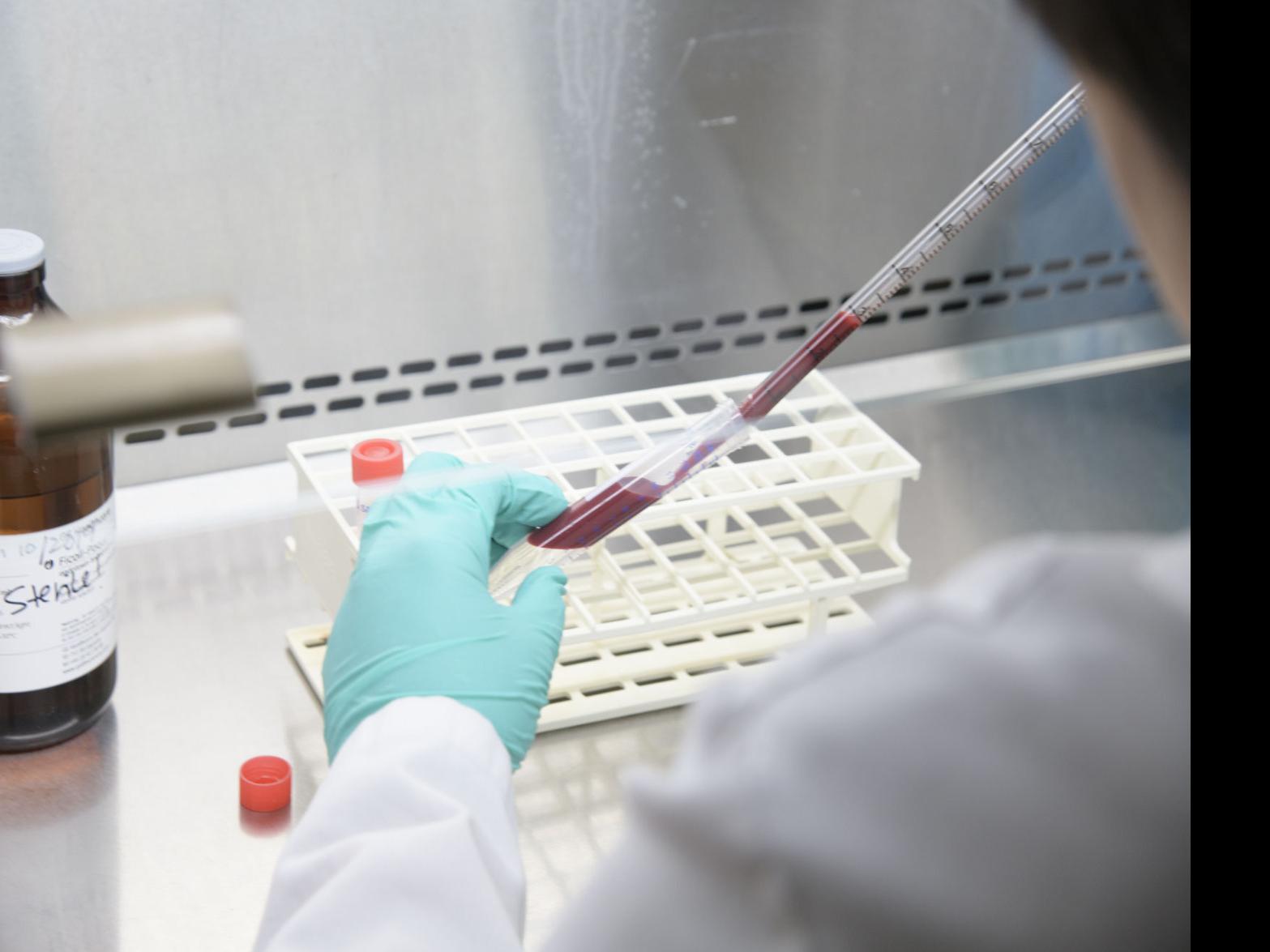 University Of Arizona Opens Up Coronavirus Antibody Testing To