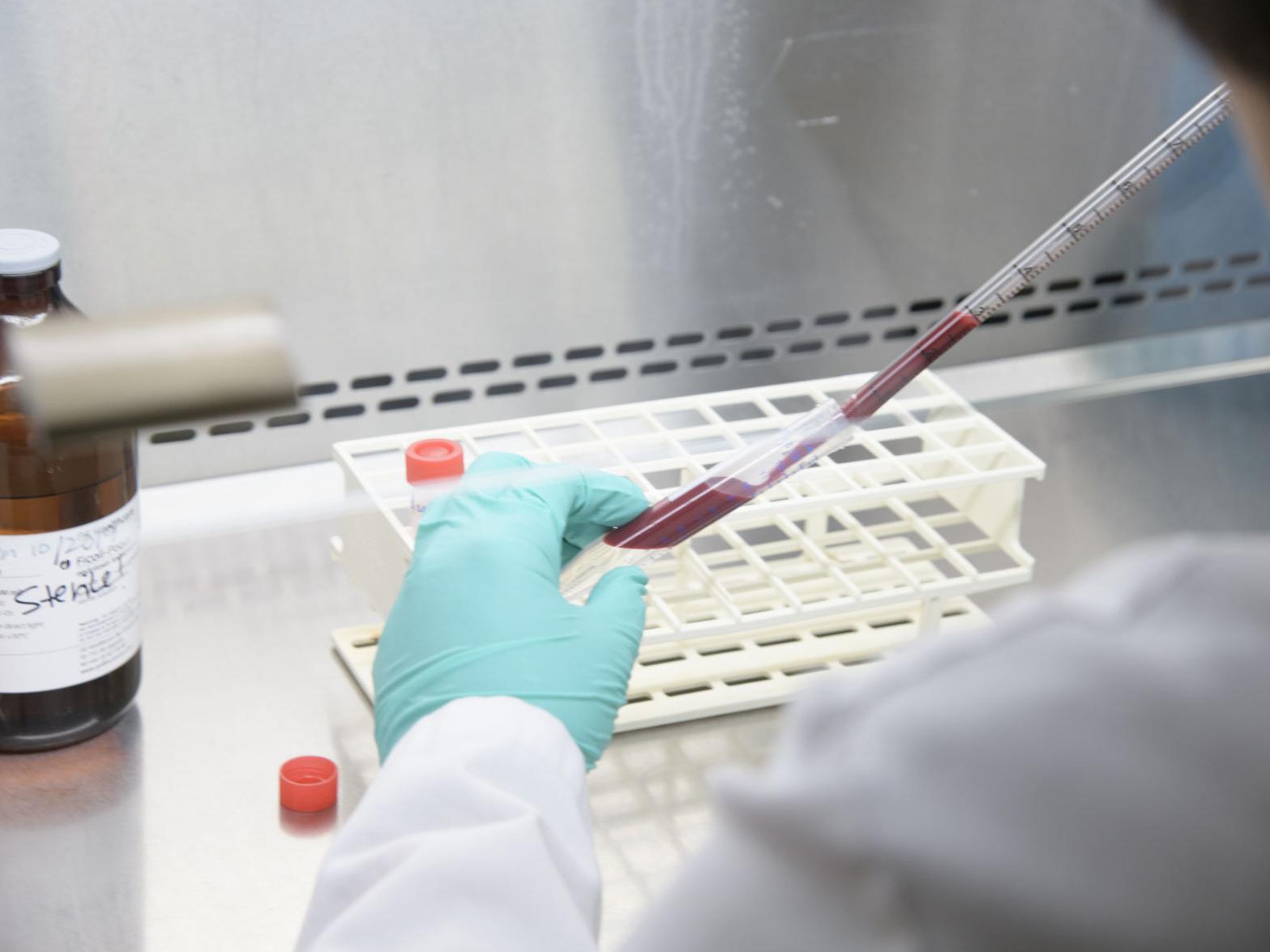 University Of Arizona Opens Up Coronavirus Antibody Testing To Community Members Local News Tucson Com