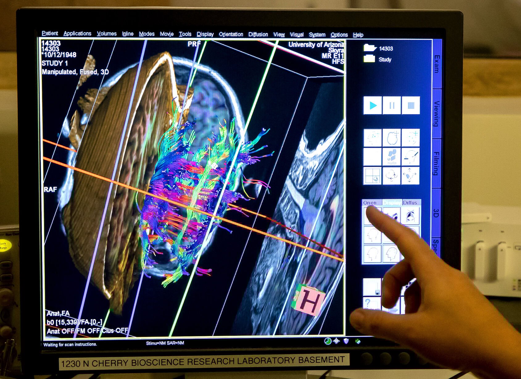 Precision Aging Network