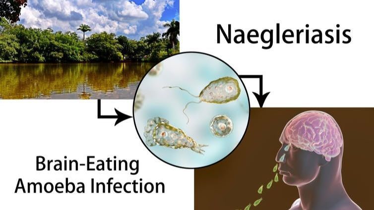 Why The 'brain-eating' Amoeba Found In Freshwater Lakes – While Rare ...