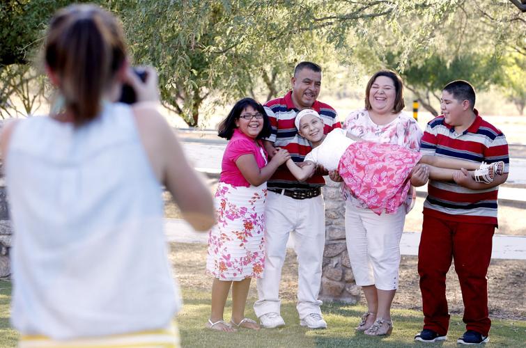 Bald Beauties Project