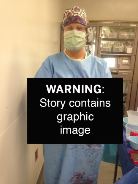 Tumor Warning