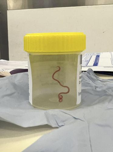 Australia Brain Parasite