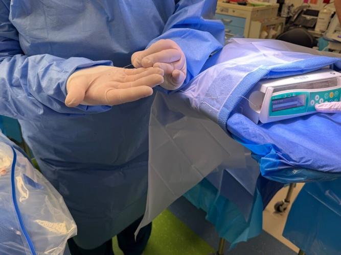 Jennifer Schmid, surgical technologist at Children’s Wisconsin, holds the catheter used during a procedure to deliver a newly approved gene therapy into the ears of the Plumb sisters on July 20 in Milwaukee. The therapy is infused directly to reach the c