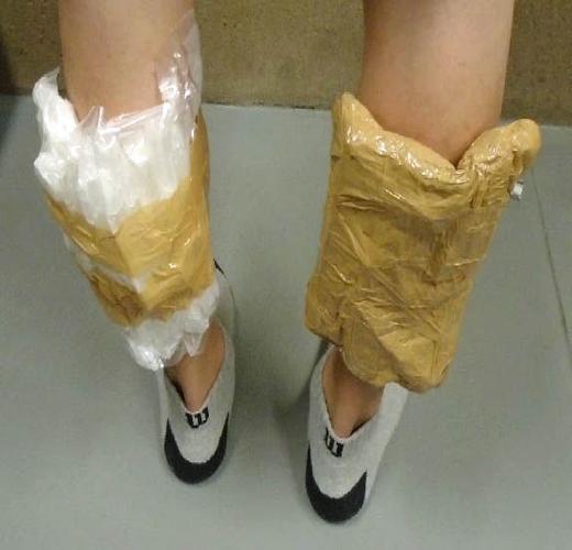 Meth legs
