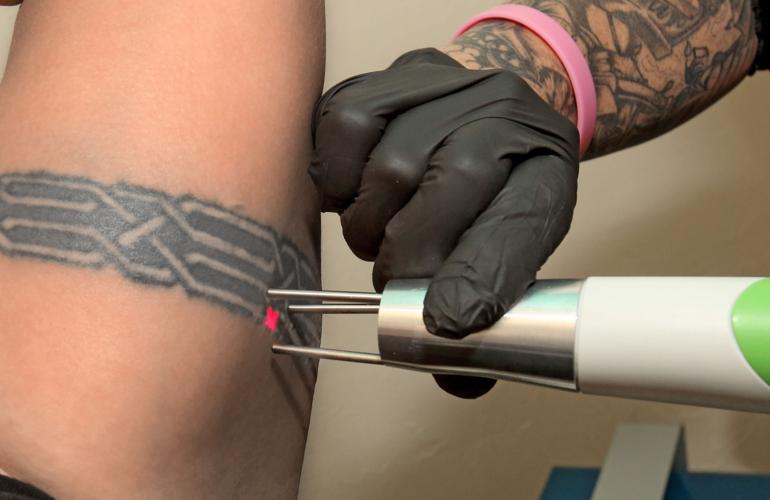 Tucson couple makes their mark on tattoo scene as artist, removal tech