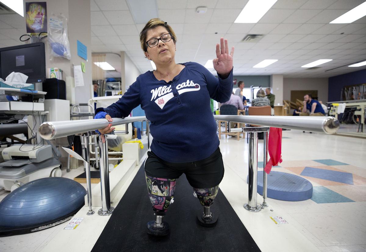 Yvonne Llanes: Double Above-Knee Amputee Leaves Her Wheelchair Behind and  Adjusts to Life with Prosthetics