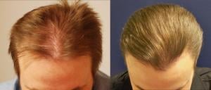 Before and After