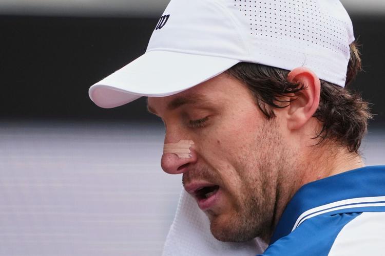 French Open Nose Strips Tennis