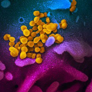 Ua State Of Arizona Developing Covid 19 Antibody Tests News Tucsonlocalmedia Com