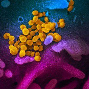 Ua State Of Arizona Developing Covid 19 Antibody Tests News Tucsonlocalmedia Com