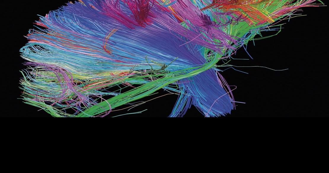 Muse’s ‘2nd Law’ a shining example of the musical eclectic | Culture ...